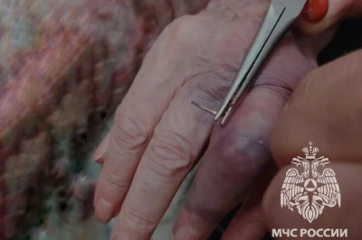 В Казани спасатели сняли кольцо с пальца 89-летней женщины